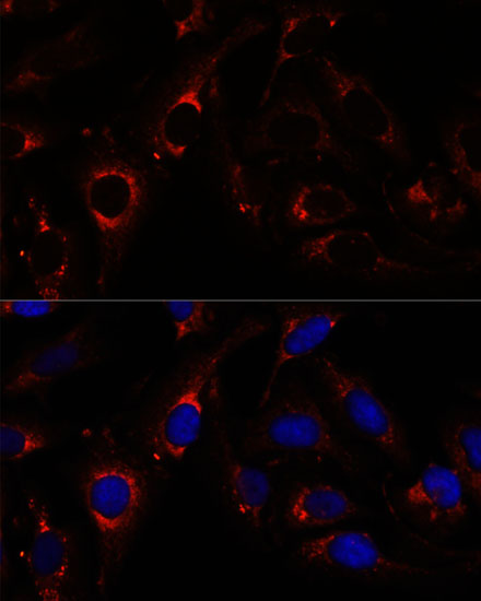 Immunocytochemistry/ Immunofluorescence: ZNF179 Antibody - Azide and BSA Free [NBP2-93335] - Immunofluorescence analysis of U-2 OS cells using ZNF179 Rabbit pAb  at dilution of 1:100. Secondary antibody: Cy3 Goat Anti-Rabbit IgG (H+L)  at 1:500 dilution. Blue: DAPI for nuclear staining.