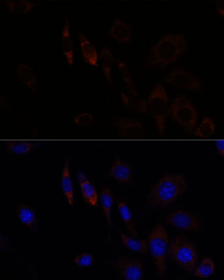 Immunocytochemistry/ Immunofluorescence: ZNF179 Antibody - Azide and BSA Free [NBP2-93335] - Immunofluorescence analysis of L929 cells using ZNF179 Rabbit pAb  at dilution of 1:100. Secondary antibody: Cy3 Goat Anti-Rabbit IgG (H+L)  at 1:500 dilution. Blue: DAPI for nuclear staining.