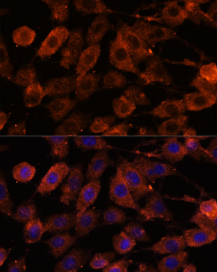 Immunocytochemistry/ Immunofluorescence: Teneurin-1 Antibody - Azide and BSA Free [NBP2-93336] - Immunofluorescence analysis of L929 cells using Teneurin-1 Rabbit pAb  at dilution of 1:100. Secondary antibody: Cy3 Goat Anti-Rabbit IgG (H+L)  at 1:500 dilution. Blue: DAPI for nuclear staining.