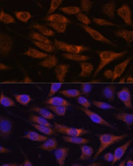 Immunocytochemistry/ Immunofluorescence: UNC13B Antibody - Azide and BSA Free [NBP2-93337] - Immunofluorescence analysis of L929 cells using UNC13B Rabbit pAb  at dilution of 1:100. Secondary antibody: Cy3 Goat Anti-Rabbit IgG (H+L)  at 1:500 dilution. Blue: DAPI for nuclear staining.