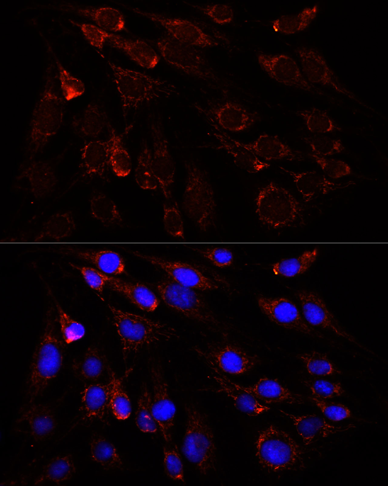 Immunocytochemistry/ Immunofluorescence: SLC25A1 Antibody - BSA Free [NBP2-93363] - Immunofluorescence analysis of C6 cells using SLC25A1 antibody  at dilution of 1:100. Blue: DAPI for nuclear staining.