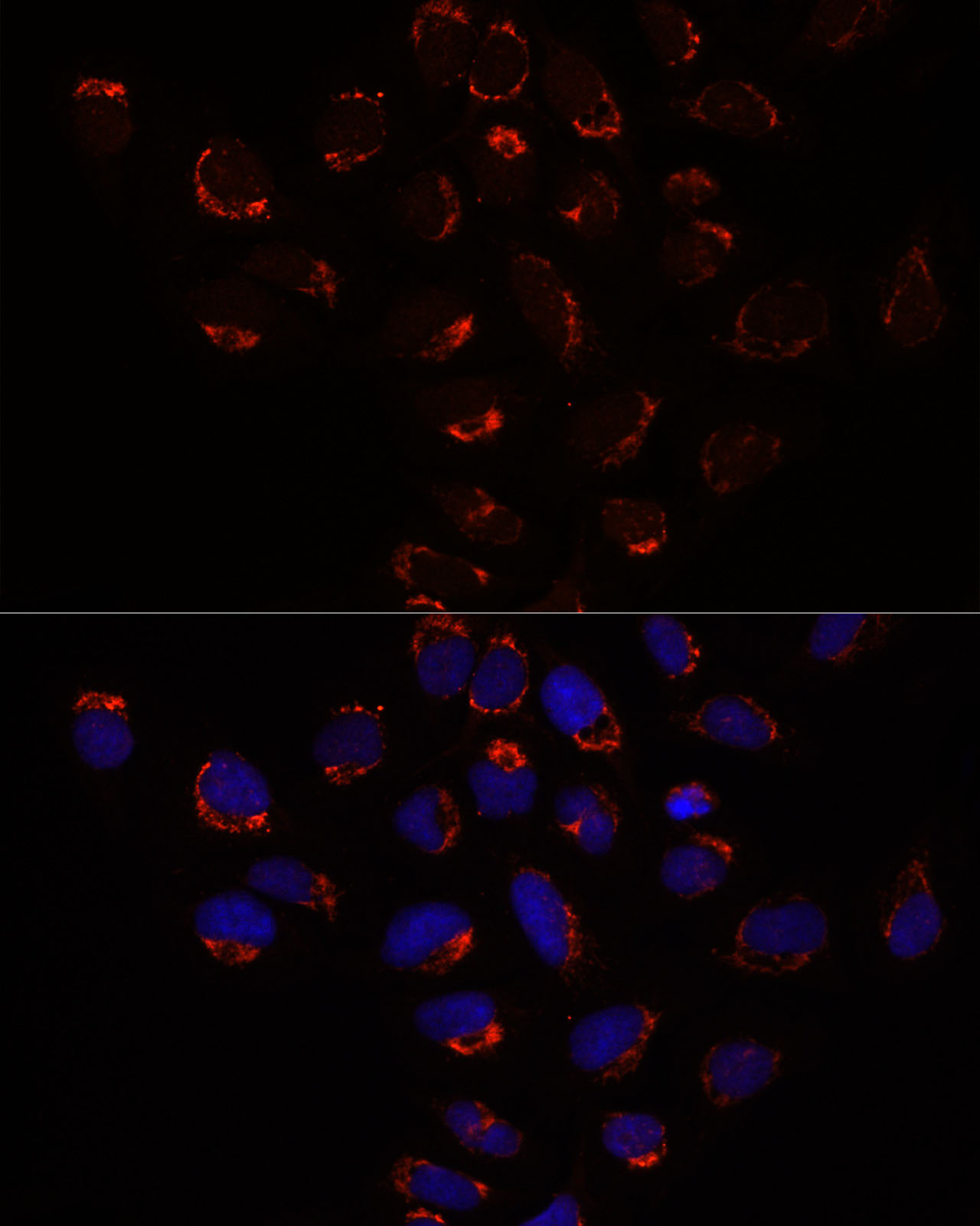 Immunocytochemistry/ Immunofluorescence: SLC25A1 Antibody - BSA Free [NBP2-93363] - Immunofluorescence analysis of U2OS cells using SLC25A1 antibody  at dilution of 1:100. Blue: DAPI for nuclear staining.