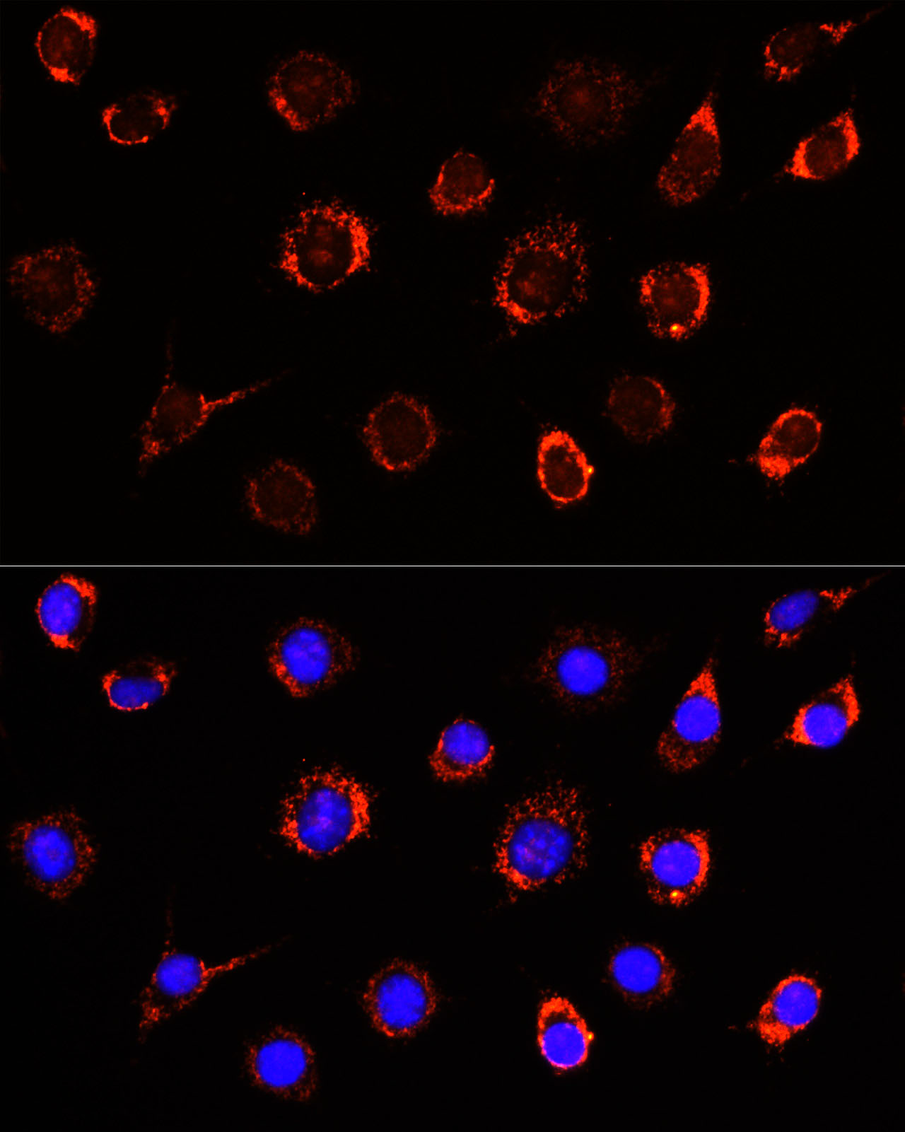 Immunocytochemistry/ Immunofluorescence: SLC25A1 Antibody - BSA Free [NBP2-93363] - Immunofluorescence analysis of L929 cells using SLC25A1 antibody  at dilution of 1:100. Blue: DAPI for nuclear staining.