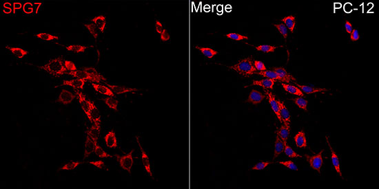 Immunocytochemistry/ Immunofluorescence: SPG7 Antibody - BSA Free [NBP2-93364] - Immunofluorescence analysis of PC-12 cells using SPG7 Rabbit pAb  at dilution of 1:50 (40x lens). Secondary antibody: Cy3 Goat Anti-Rabbit IgG (H+L)  at 1:500 dilution. Blue: DAPI for nuclear staining.