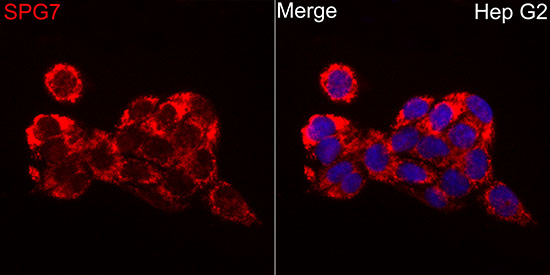 Immunocytochemistry/ Immunofluorescence: SPG7 Antibody - BSA Free [NBP2-93364] - Immunofluorescence analysis of HepG2 cells using SPG7 Rabbit pAb  at dilution of 1:50 (40x lens). Secondary antibody: Cy3 Goat Anti-Rabbit IgG (H+L)  at 1:500 dilution. Blue: DAPI for nuclear staining.