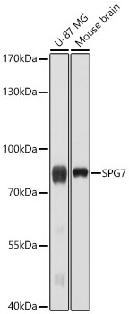 Western Blot: SPG7 Antibody - BSA Free [NBP2-93364] - Western blot analysis of various lysates using SPG7 Rabbit pAb  at 1:1000 dilution. Secondary antibody: HRP Goat Anti-Rabbit IgG (H+L)  at 1:10000 dilution. Lysates / proteins: 25 ug per lane. Blocking buffer: 3 % nonfat dry milk in TBST. Detection: ECL Enhanced Kit. Exposure time: 10s.