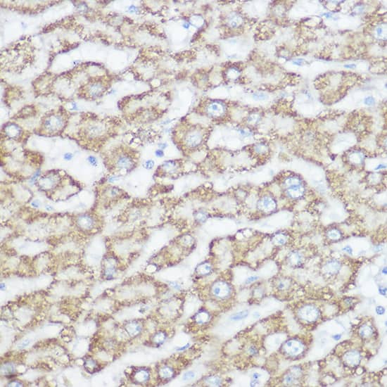 Immunohistochemistry: NDUFA4 Antibody - Azide and BSA Free [NBP2-93390] - Immunohistochemistry analysis of paraffin-embedded human liver using NDUFA4 Rabbit pAb  at dilution of 1:300 (40x lens).Perform high pressure antigen retrieval with 10 mM citrate buffer pH 6.0 before commencing with IHC staining protocol.