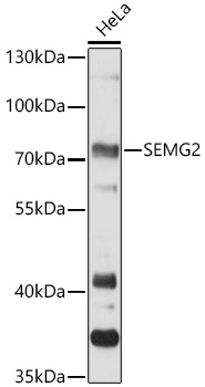 Western Blot: Semenogelin II Antibody - Azide and BSA Free [NBP2-93405] - Western blot analysis of lysates from HeLa cells, using Semenogelin II Rabbit pAb  at 1:3000 dilution.Secondary antibody: HRP Goat Anti-Rabbit IgG (H+L)  at 1:10000 dilution.Lysates/proteins: 25ug per lane.Blocking buffer: 3% nonfat dry milk in TBST.Detection: ECL Basic Kit.Exposure time: 30s.