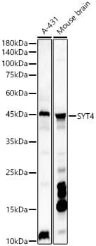 Western Blot: Synaptotagmin 4 Antibody - BSA Free [NBP2-93411] - Western blot analysis of various lysates, using Synaptotagmin 4 Rabbit pAb  at 1:1000 dilution.Secondary antibody: HRP Goat Anti-Rabbit IgG (H+L)  at 1:10000 dilution.Lysates/proteins: 25ug per lane.Blocking buffer: 3% nonfat dry milk in TBST.Detection: ECL Basic Kit.Exposure time: 180s.