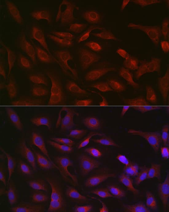 Immunocytochemistry/ Immunofluorescence: GSDMDC1 Antibody - Azide and BSA Free [NBP2-93428] - Immunofluorescence analysis of U2OS cells using GSDMD Rabbit pAb  at dilution of 1:200 (40x lens). Secondary antibody: Cy3-conjugated Goat anti-Rabbit IgG (H+L)  at 1:500 dilution. Blue: DAPI for nuclear staining.