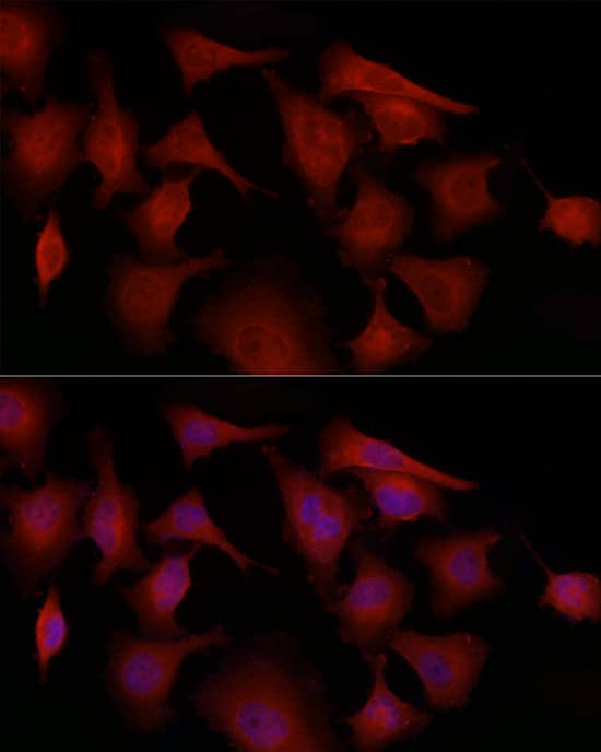 Immunocytochemistry/ Immunofluorescence: GSDMDC1 Antibody - Azide and BSA Free [NBP2-93428] - Immunofluorescence analysis of PC-3 cells using GSDMD Rabbit pAb  at dilution of 1:100 (40x lens). Secondary antibody: Cy3-conjugated Goat anti-Rabbit IgG (H+L)  at 1:500 dilution. Blue: DAPI for nuclear staining.