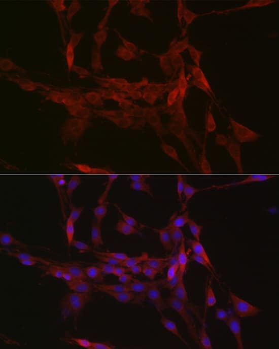 Immunocytochemistry/ Immunofluorescence: GSDMDC1 Antibody - Azide and BSA Free [NBP2-93428] - Immunofluorescence analysis of PC-12 cells using GSDMD Rabbit pAb  at dilution of 1:200 (40x lens). Secondary antibody: Cy3-conjugated Goat anti-Rabbit IgG (H+L)  at 1:500 dilution. Blue: DAPI for nuclear staining.