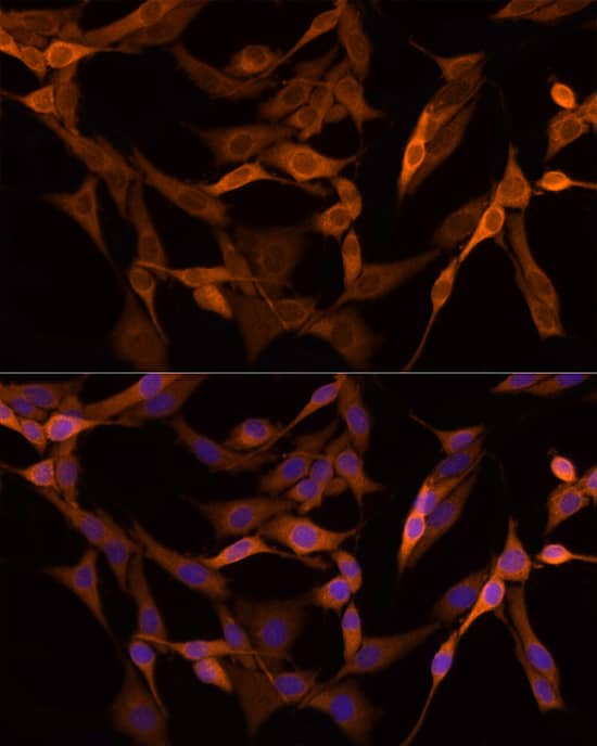 Immunocytochemistry/ Immunofluorescence: GSDMDC1 Antibody - Azide and BSA Free [NBP2-93428] - Immunofluorescence analysis of PC-12 cells using GSDMD Rabbit pAb  at dilution of 1:100 (40x lens). Secondary antibody: Cy3-conjugated Goat anti-Rabbit IgG (H+L)  at 1:500 dilution. Blue: DAPI for nuclear staining.