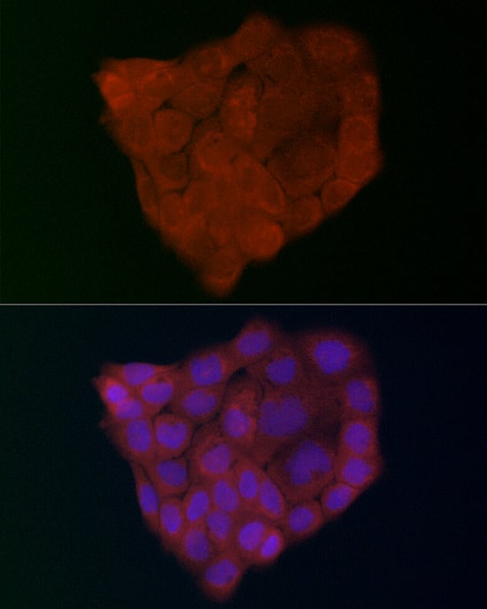 Immunocytochemistry/ Immunofluorescence: GSDMDC1 Antibody - Azide and BSA Free [NBP2-93428] - Immunofluorescence analysis of A-431 cells using GSDMD (Full Length+N terminal) Rabbit pAb  at dilution of 1:200 (40x lens). Secondary antibody: Cy3-conjugated Goat anti-Rabbit IgG (H+L)  at 1:500 dilution. Blue: DAPI for nuclear staining.