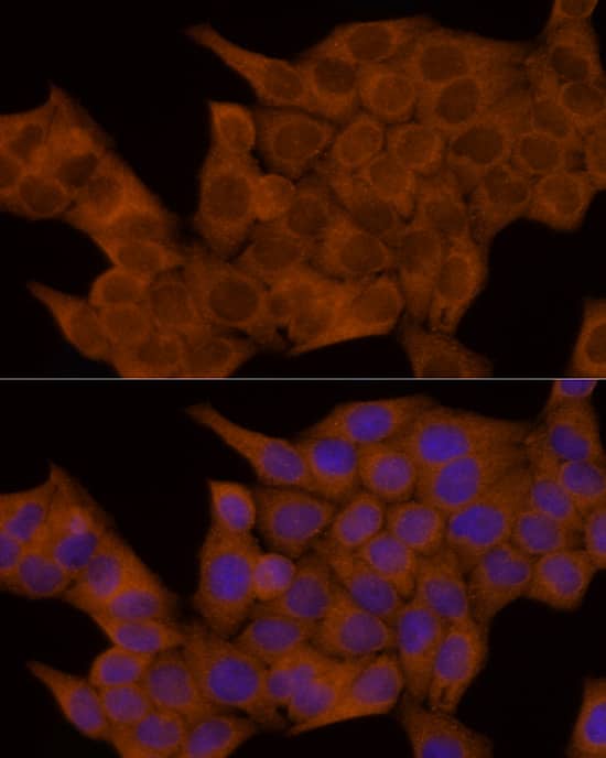 Immunocytochemistry/ Immunofluorescence: GSDMDC1 Antibody - Azide and BSA Free [NBP2-93428] - Immunofluorescence analysis of HeLa cells using GSDMD Rabbit pAb  at dilution of 1:100 (40x lens). Secondary antibody: Cy3-conjugated Goat anti-Rabbit IgG (H+L)  at 1:500 dilution. Blue: DAPI for nuclear staining.