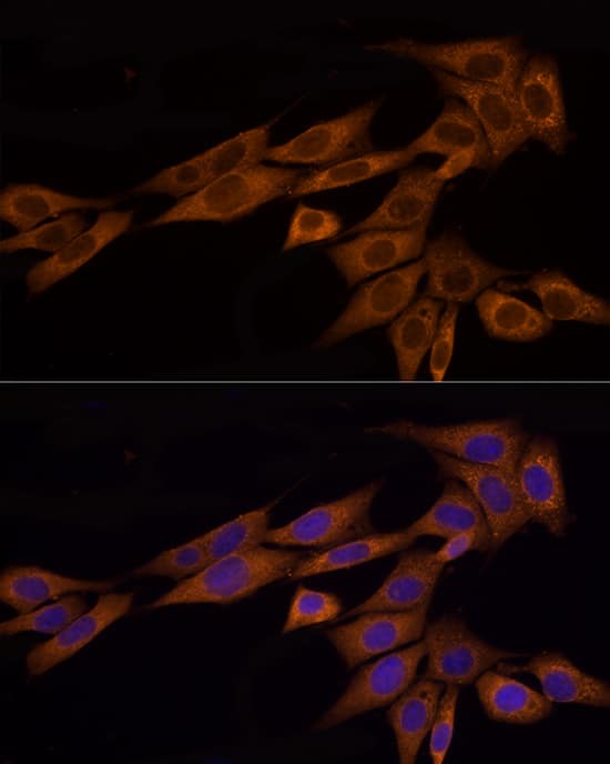 Immunocytochemistry/ Immunofluorescence: GSDMDC1 Antibody - Azide and BSA Free [NBP2-93428] - Immunofluorescence analysis of NIH/3T3 cells using GSDMD Rabbit pAb  at dilution of 1:100 (40x lens). Secondary antibody: Cy3-conjugated Goat anti-Rabbit IgG (H+L)  at 1:500 dilution. Blue: DAPI for nuclear staining.