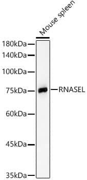 Western Blot: RNase L Antibody - BSA Free [NBP2-93434] - Western blot analysis of lysates from Mouse spleen, using RNase L Rabbit pAb  at  1:400 dilution.Secondary antibody: HRP-conjugated Goat anti-Rabbit IgG (H+L)  at 1:10000 dilution.Lysates/proteins: 25ug per lane.Blocking buffer: 3% nonfat dry milk in TBST.Detection: ECL Basic Kit.Exposure time: 10s.