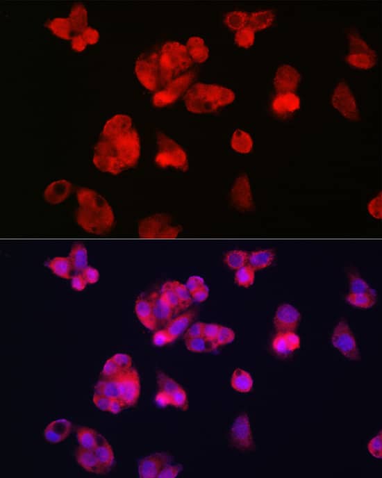 Immunocytochemistry/ Immunofluorescence: TfR2 Antibody - Azide and BSA Free [NBP2-93436] - Immunofluorescence analysis of HepG2 cells using TfR2 Rabbit pAb  at dilution of 1:100 (40x lens). Secondary antibody: Cy3-conjugated Goat anti-Rabbit IgG (H+L)  at 1:500 dilution. Blue: DAPI for nuclear staining.