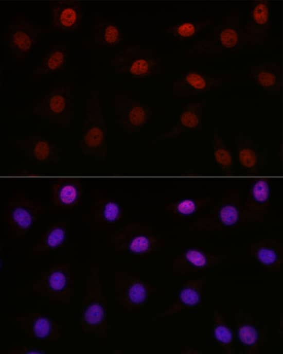 Immunocytochemistry/ Immunofluorescence: SETD8 Antibody - BSA Free [NBP2-93444] - Immunofluorescence analysis of NIH-3T3 cells using KMT5A/SETD8 Rabbit pAb  at dilution of 1:100 (40x lens). Secondary antibody: Cy3-conjugated Goat anti-Rabbit IgG (H+L)  at 1:500 dilution. Blue: DAPI for nuclear staining.