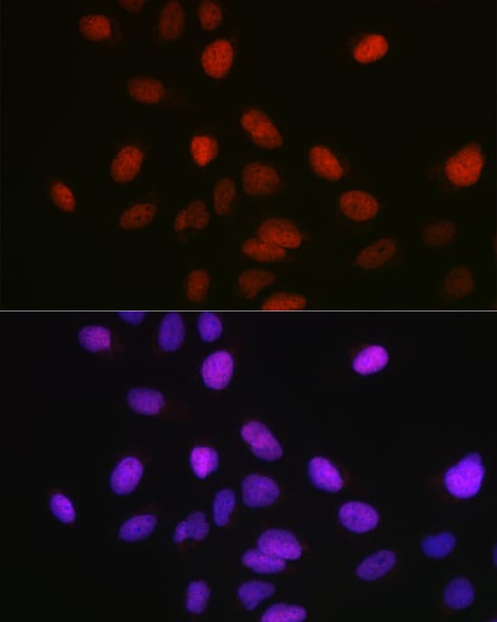 Immunocytochemistry/ Immunofluorescence: SETD8 Antibody - BSA Free [NBP2-93444] - Immunofluorescence analysis of U-2 OS cells using KMT5A/SETD8 Rabbit pAb  at dilution of 1:100 (40x lens). Secondary antibody: Cy3-conjugated Goat anti-Rabbit IgG (H+L)  at 1:500 dilution. Blue: DAPI for nuclear staining.