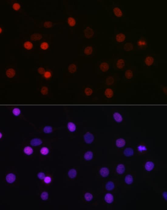 Immunocytochemistry/ Immunofluorescence: SETD8 Antibody - BSA Free [NBP2-93444] - Immunofluorescence analysis of C6 cells using KMT5A/SETD8 Rabbit pAb  at dilution of 1:100 (40x lens). Secondary antibody: Cy3-conjugated Goat anti-Rabbit IgG (H+L)  at 1:500 dilution. Blue: DAPI for nuclear staining.