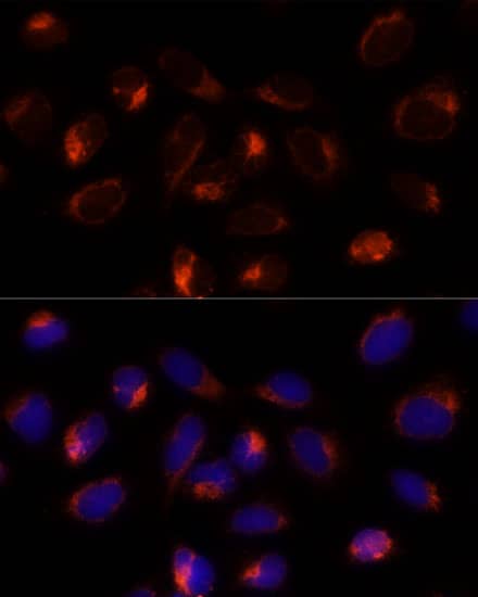 Immunocytochemistry/ Immunofluorescence: TXNDC12 Antibody - Azide and BSA Free [NBP2-93457] - Immunofluorescence analysis of U-2 OS cells using TXNDC12 Rabbit pAb  at dilution of 1:100 (40x lens). Secondary antibody: Cy3 Goat Anti-Rabbit IgG (H+L)  at 1:500 dilution. Blue: DAPI for nuclear staining.