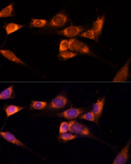 Immunocytochemistry/ Immunofluorescence: TXNDC12 Antibody - Azide and BSA Free [NBP2-93457] - Immunofluorescence analysis of NIH-3T3 cells using TXNDC12 Rabbit pAb  at dilution of 1:100 (40x lens). Secondary antibody: Cy3 Goat Anti-Rabbit IgG (H+L)  at 1:500 dilution. Blue: DAPI for nuclear staining.