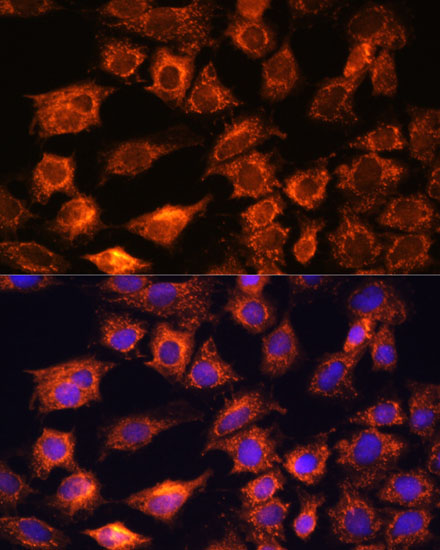 Immunocytochemistry/ Immunofluorescence PTCD1 Antibody - Azide and BSA Free