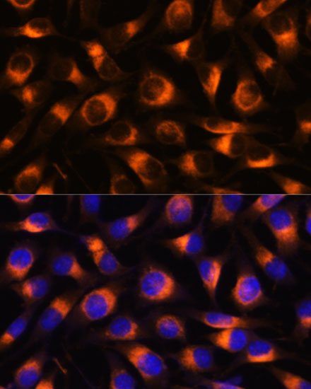 Immunocytochemistry/ Immunofluorescence VAT1 Antibody - Azide and BSA Free