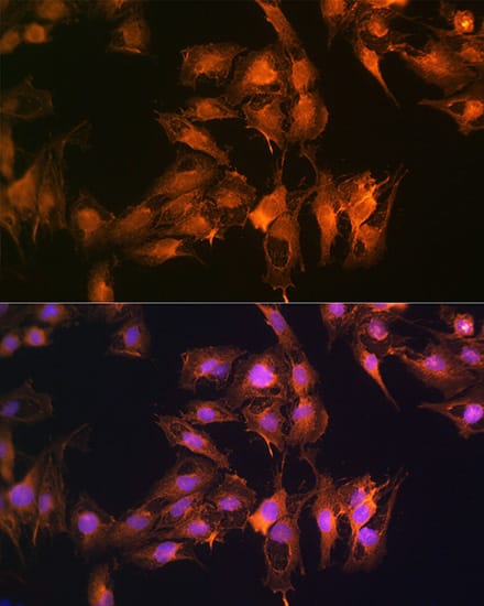 Immunocytochemistry/ Immunofluorescence: S100 calcium binding protein A14 Antibody - BSA Free [NBP2-93478] - Immunofluorescence analysis of C6 cells using S100 calcium binding protein A14 Rabbit pAb  at dilution of 1:100 (40x lens). Secondary antibody: Cy3 Goat Anti-Rabbit IgG (H+L)  at 1:500 dilution. Blue: DAPI for nuclear staining.