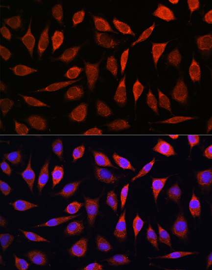 Immunocytochemistry/ Immunofluorescence: SLC39A8/ZIP8 Antibody - BSA Free [NBP2-93479] - Immunofluorescence analysis of L929 cells using SLC39A8/ZIP8 Rabbit pAb  at dilution of 1:100. Blue: DAPI for nuclear staining.