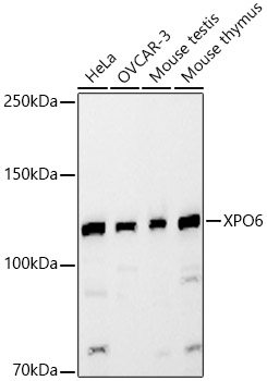 Western Blot: XPO6 Antibody - BSA Free [NBP2-93480] - Western blot analysis of various lysates, using XPO6 Rabbit pAb  at 1:2000 dilution.Secondary antibody: HRP Goat Anti-Rabbit IgG (H+L)  at 1:10000 dilution.Lysates/proteins: 25ug per lane.Blocking buffer: 3% nonfat dry milk in TBST.Detection: ECL Basic Kit.Exposure time: 30s.