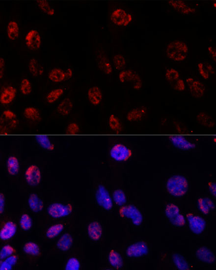 Immunocytochemistry/ Immunofluorescence: Proteasome beta 1 Antibody - BSA Free [NBP2-93490] - Immunofluorescence analysis of C6 cells using Proteasome beta 1 antibody  at dilution of 1:100. Blue: DAPI for nuclear staining.