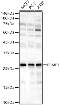 Western Blot: Proteasome beta 1 Antibody - BSA Free [NBP2-93490] - Western blot analysis of various lysates, using Proteasome beta 1 Rabbit pAb  at 1:3500 dilution.Secondary antibody: HRP Goat Anti-Rabbit IgG (H+L)  at 1:10000 dilution.Lysates/proteins: 25ug per lane.Blocking buffer: 3% nonfat dry milk in TBST.Detection: ECL Basic Kit.Exposure time: 180s.