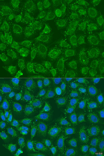 Immunocytochemistry/ Immunofluorescence MSS4 Antibody - BSA Free