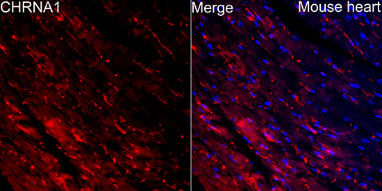 Immunocytochemistry/ Immunofluorescence: Nicotinic Acetylcholine R alpha 1/CHRNA1 Antibody - BSA Free [NBP2-93514] - Immunofluorescence analysis of paraffin-embedded Mouse heart using Nicotinic Acetylcholine R alpha 1/CHRNA1 Rabbit pAb at a dilution of 1:100 (40x lens). Secondary antibody:Cy3 Goat Anti-Rabbit IgG (H+L) at 1:500 dilution. Blue: DAPI for nuclear staining.Perform high pressure antigen retrieval with 0.01 M citrate buffer (pH 6.0) prior to IF staining.
