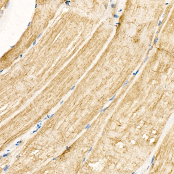 Immunohistochemistry: Nicotinic Acetylcholine R alpha 1/CHRNA1 Antibody - BSA Free [NBP2-93514] - Immunohistochemistry analysis of Nicotinic Acetylcholine R alpha 1/CHRNA1 in paraffin-embedded Human skeletal muscle tissue using Nicotinic Acetylcholine R alpha 1/CHRNA1 Rabbit pAb  at a dilution of 1:100 (40x lens). High pressure antigen retrieval was performed with 0.01 M citrate buffer (pH 6.0) prior to IHC staining.