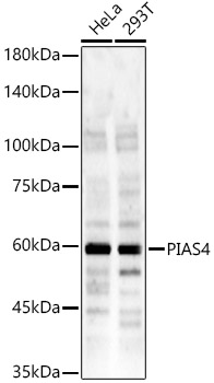 Western Blot: PIASy Antibody - BSA Free [NBP2-93515] - Western blot analysis of various lysates, using PIASy Rabbit pAb  at 1:400 dilution.Secondary antibody: HRP Goat Anti-Rabbit IgG (H+L)  at 1:10000 dilution.Lysates/proteins: 25ug per lane.Blocking buffer: 3% nonfat dry milk in TBST.Detection: ECL Enhanced Kit.Exposure time: 90s.