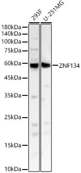 Western Blot: ZNF134 Antibody - Azide and BSA Free [NBP2-93519] - Western blot analysis of various lysates, using ZNF134 Rabbit pAb  at 1:400 dilution.Secondary antibody: HRP-conjugated Goat anti-Rabbit IgG (H+L)  at 1:10000 dilution.Lysates/proteins: 25ug per lane.Blocking buffer: 3% nonfat dry milk in TBST.Detection: ECL Basic Kit.Exposure time: 60s.