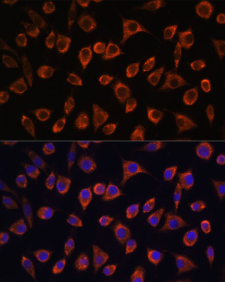 Immunocytochemistry/ Immunofluorescence: MRPL43 Antibody - Azide and BSA Free [NBP2-93527] - Immunofluorescence analysis of L929 cells using MRPL43 Rabbit pAb  at dilution of 1:100. Secondary antibody: Cy3 Goat Anti-Rabbit IgG (H+L)  at 1:500 dilution. Blue: DAPI for nuclear staining.