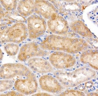 Immunohistochemistry-Paraffin: MT-ND4 Antibody [NBP2-93530] -Analysis of rat kidney using MT-ND4 Rabbit pAb at dilution of 1:200 (40x lens). Perform high pressure antigen retrieval with 10 mM citrate buffer pH 6.0 before commencing with IHC staining protocol.