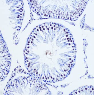Immunohistochemistry-Paraffin: VGLL4 Antibody [NBP2-93539] -Rat testis using Vgll4 Rabbit pAb at dilution of 1:100 (20x lens). Microwave antigen retrieval performed with 0.01M Tris/EDTA Buffer (pH 9.0) prior to IHC staining.