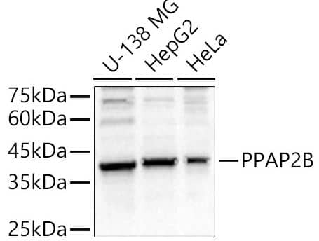 Western Blot: PPAP2B Antibody [NBP2-93554] - analysis of various lysates, using PPAP2B antibody at 1:1000 dilution.Secondary antibody: HRP Goat Anti-Rabbit IgG (H+L) at 1:10000 dilution.Lysates/proteins: 25ug per lane.Blocking buffer: 3% nonfat dry milk in TBST.Detection: ECL Basic Kit.Exposure time: 10s.