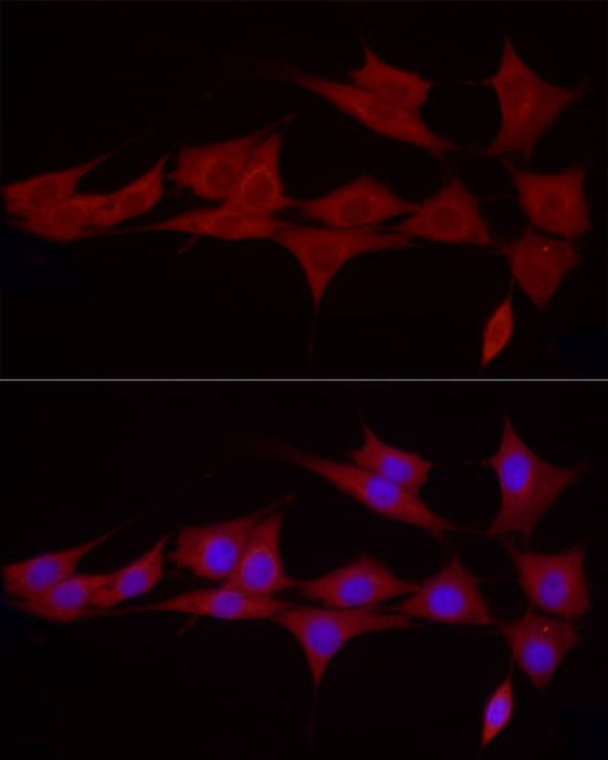 Immunocytochemistry/ Immunofluorescence: SGPL1 Antibody - Azide and BSA Free [SGPL1] - Immunofluorescence analysis of NIH/3T3 cells using SGPL1 Rabbit pAb  at dilution of 1:50 (40x lens). Secondary antibody: Cy3-conjugated Goat anti-Rabbit IgG (H+L)  at 1:500 dilution. Blue: DAPI for nuclear staining.