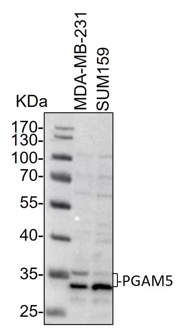 Western Blot: Rabbit Polyclonal PGAM5 Antibody [NBP2-93600] - Whole cell lysates from MDA-MB-231 and SUM159 cells were loaded with 50 ug/lane. 10% SDS-PAGE. PGAM5 Antibody (NBP2-93600) was used for primary antibody: 1:1000, 4℃, overnight. Image from a verified customer review.