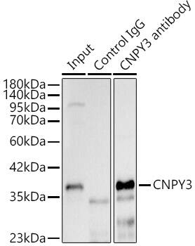 Immunoprecipitation: PRAT4A/TNRC5 Antibody - BSA Free [PRAT4A/TNRC5] - Immunoprecipitation analysis of 300ug extracts of THP-1 cells using 3ug PRAT4A/TNRC5 Rabbit pAb . Western blot was performed from the immunoprecipitate using PRAT4A/TNRC5 Rabbit pAb  at a dilition of 1:500.