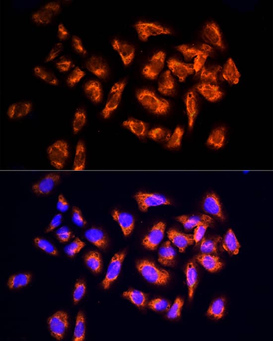 Immunocytochemistry/ Immunofluorescence NPHP4 Antibody - Azide and BSA Free