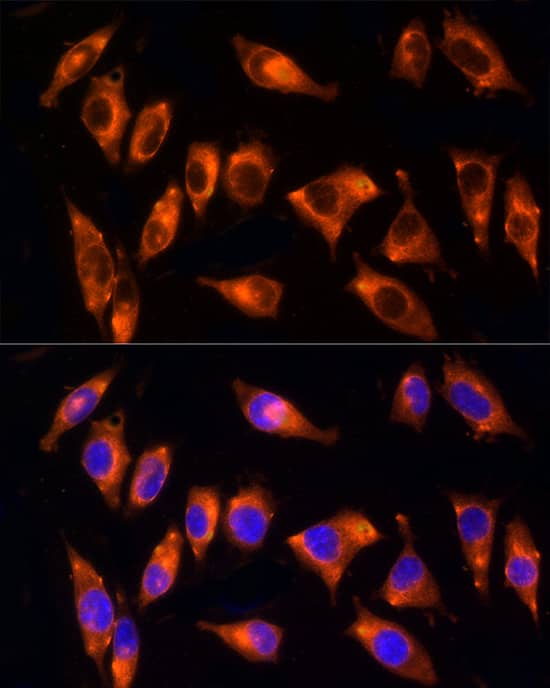 Immunocytochemistry/ Immunofluorescence NPHP4 Antibody - Azide and BSA Free