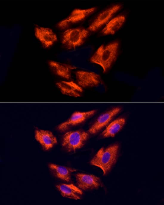 Immunocytochemistry/ Immunofluorescence: NPHP4 Antibody - Azide and BSA Free [NBP2-93637] - Immunofluorescence analysis of H9C2 cells using NPHP4 Rabbit pAb (A8934) at dilution of 100 (40x lens). Secondary antibody: Cy3 Goat Anti-Rabbit IgG (H+L) (AS007) at 1:500 dilution. Blue: DAPI for nuclear staining.