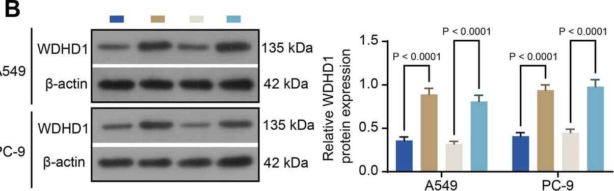 Exogenous expression of WDHD1 reverses knockdown of TET1/TET3-blocked LUAD glycolysis. (A) Transcriptional levels of WDHD1 in A549 and PC-9 cells after infection of KD-TET1 + OE-WDHD1 or KD-TET3 + OE-WDHD1 were examined using RT-qPCR. (B) The protein expression of WDHD1 in LUAD cells after infection of KD-TET1 + OE-WDHD1 or KD-TET3 + OE-WDHD1 was examined using western blot analysis. Glycolytic activity and capacity of A549 (C) and PC-9 (D) cells were analyzed. (E) Detection of 2,3-BPG contents in A549 and PC-9 cells after infection of KD-TET1 or KD-TET3 alone or combined with OE-WDHD1 by ELISA. (F) Detection of 2-PG in A549 and PC-9 cells after infection of KD-TET1 or KD-TET3 alone or combined with OE-WDHD1 by ELISA. (G) Lactate production in A549 and PC-9 cells after infection of KD-TET1 or KD-TET3 alone or combined with OE-WDHD1. p-values were calculated using two-way ANOVA. Mean +/- SEM was presented. The average results from five independent experiments are shown Image collected and cropped by CiteAb from the following open publication (//respiratory-research.biomedcentral.com/articles/10.1186/s12931-025-03399-z), licensed under a CC-BY license. Not internally tested by Novus Biologicals.